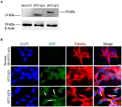 Differential microRNA expression in the SH-SY5Y human cell model as potential biomarkers for Huntington’s disease